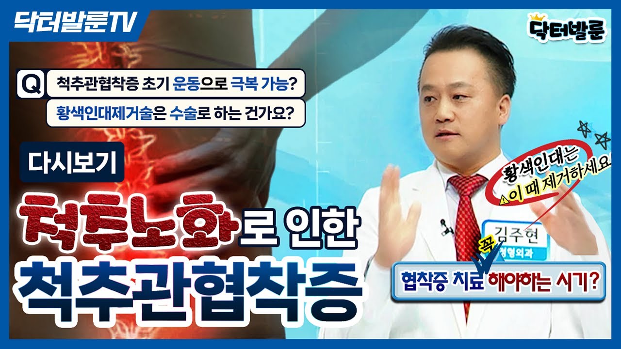 【김주현의 척추관절이야기】 척추관협착증 가장 많이 물어보시는 질문들 총정리!🤓🗒️협착증 초기·중기·말기 치료 단계별 꼭 확인하세요 (통합본) ㅣ내가 알려줄게! 닥터발룬TV