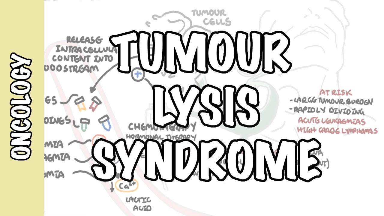 Tumour Lysis Syndrome (Tumor Lysis Syndrome) - pathophysiology, diagnosis and treatment