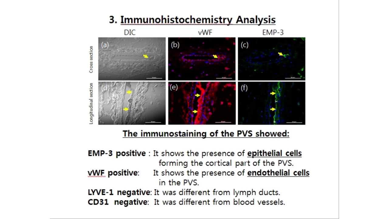 Primo Vascular System (PVS) in Lymph Ducts