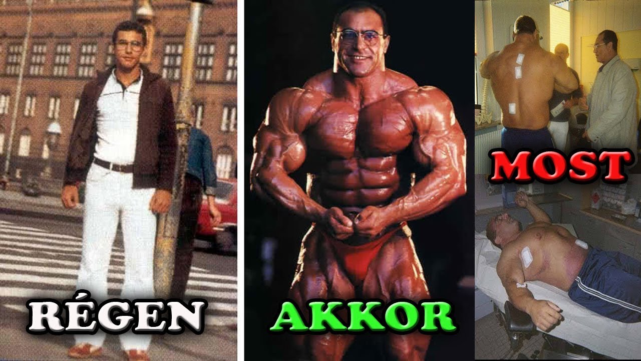 Nasser El Sonbaty - A KOKSZ ELŐBB, UTÓBB KINYÍR.. • /Top 5 Megkoronázatlan  Mr. Olympia (1.rész)