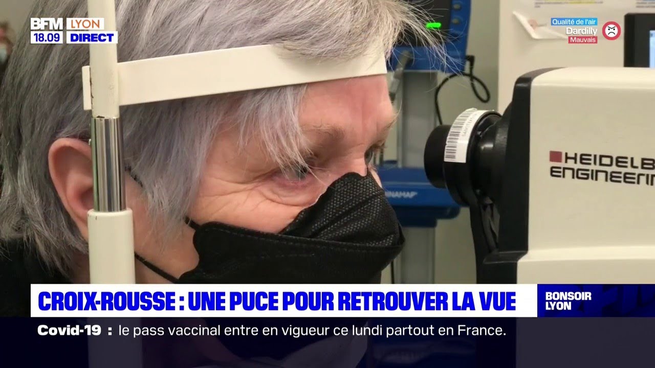 Croix-Rousse : une puce pour retrouver la vue