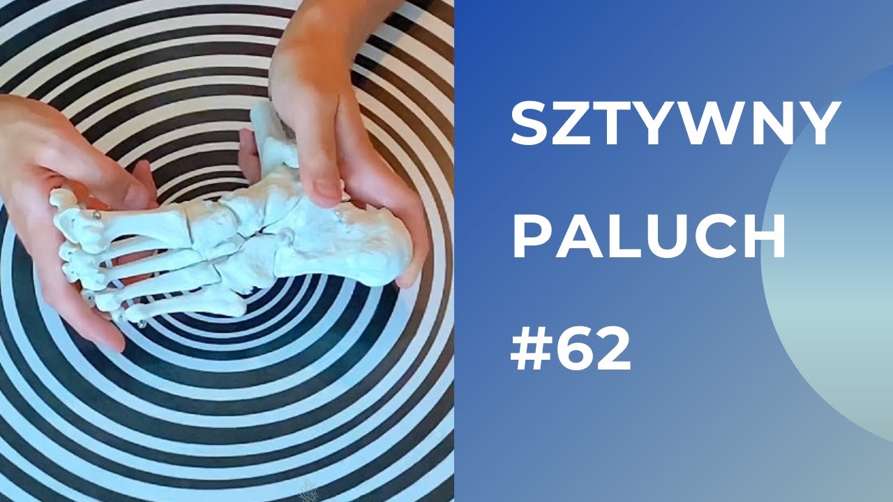 Sztywny paluch - gimnastyka - AUTOTERAPIA W 5 MINUT [#62]