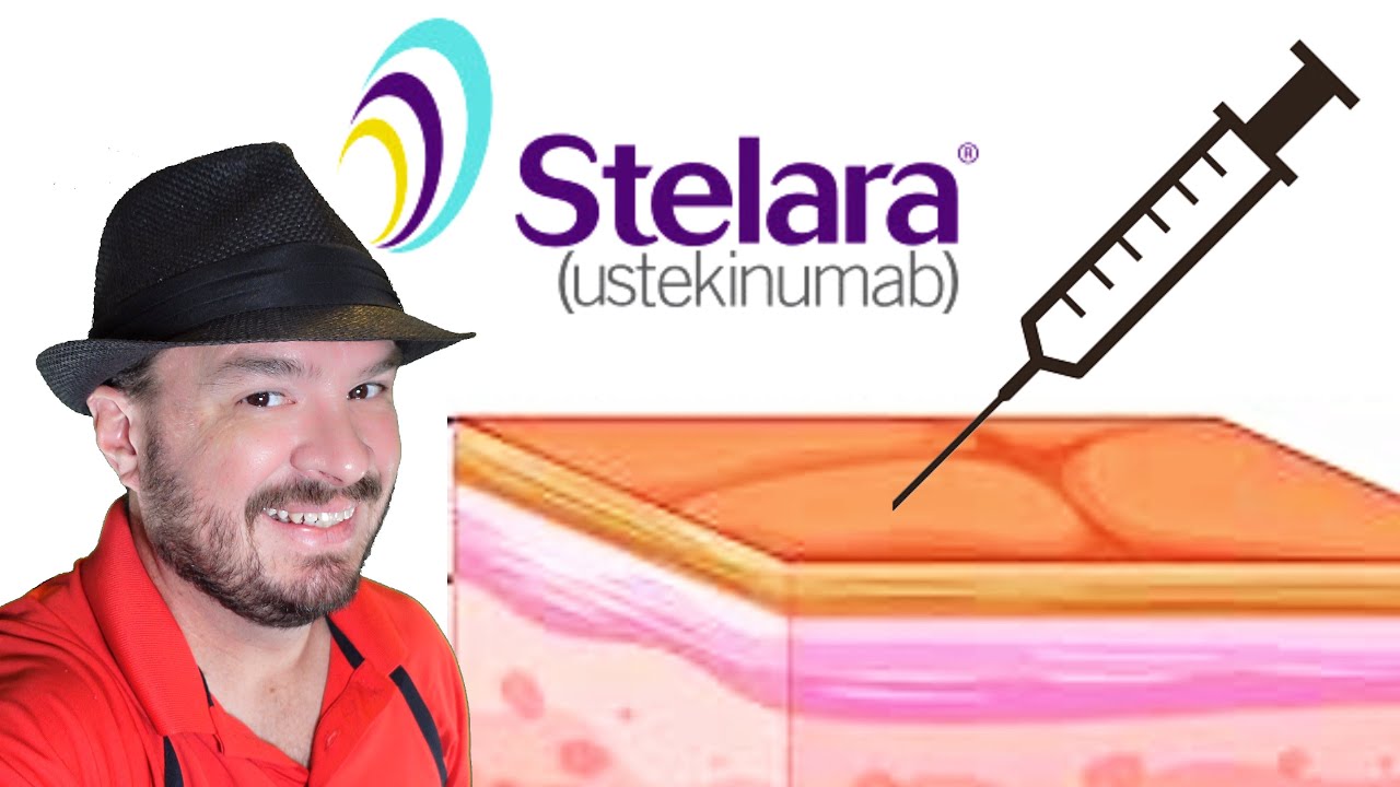 Stelara Self Injection STEP by STEP Definitive Guide | Ulcerative Colitis Treatment
