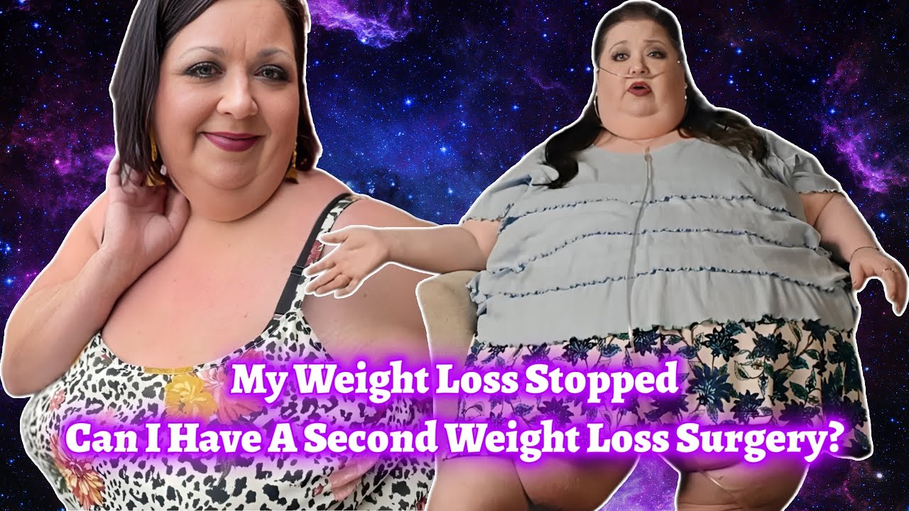 Megan Needs A Second Surgery - 1000 lb. Best Friends Reaction