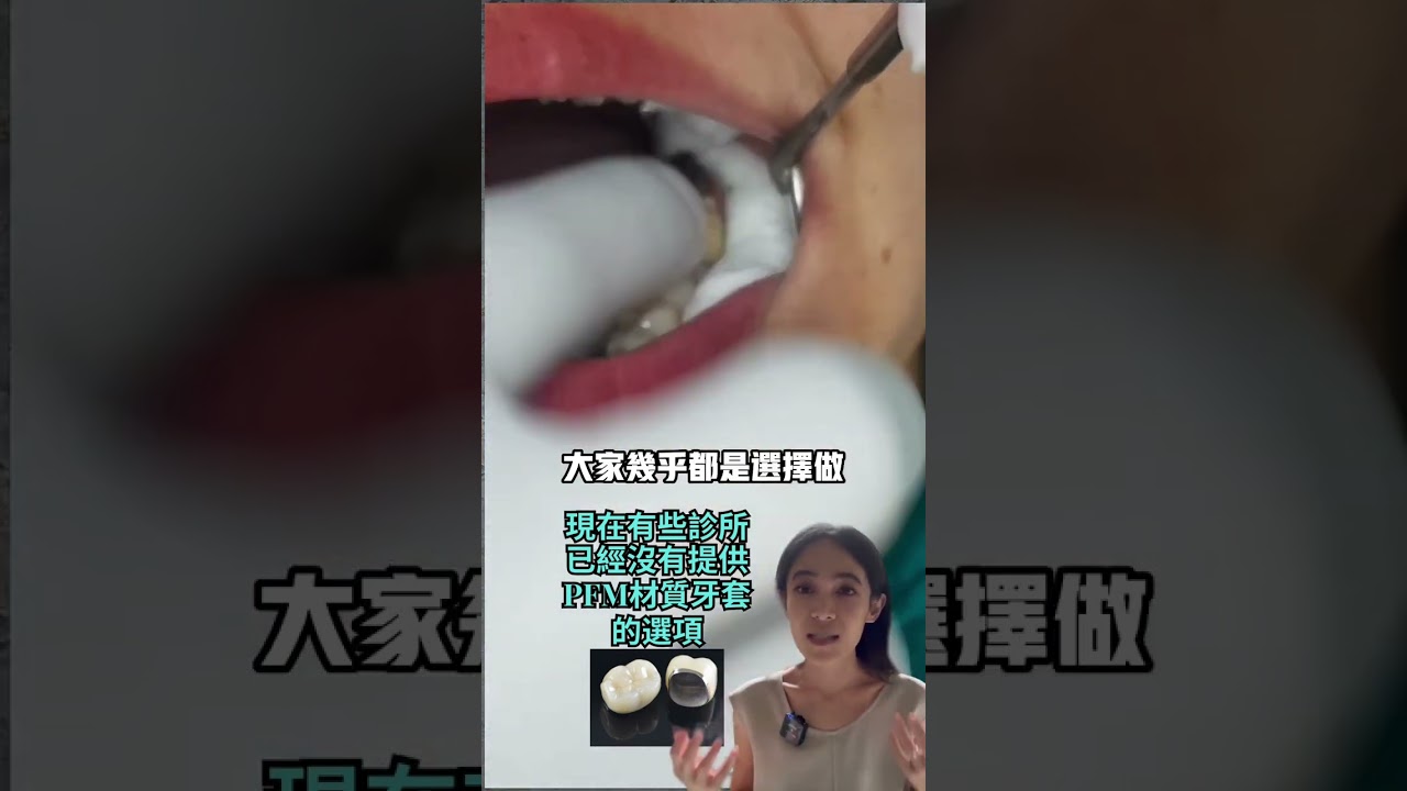 做假牙費用和房價一樣回不去了🥺