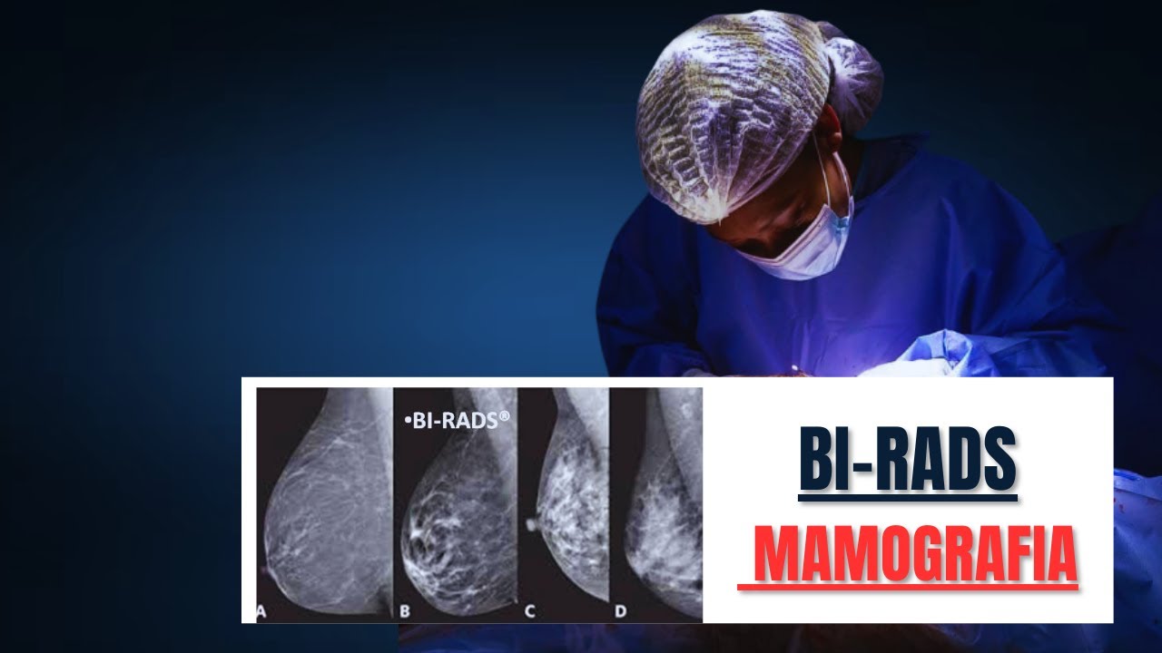 📝Classificação BI- RADS MAMOGRAFIA:  AULA de Especialização em GINECOLOGIA E OBSTETRÍCIA 