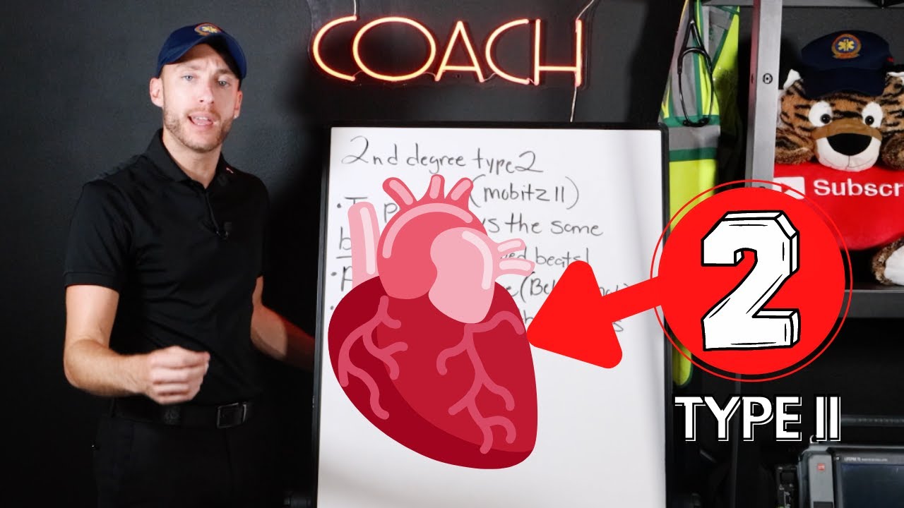 UNDERSTAND 2nd Degree Heart Block Type II