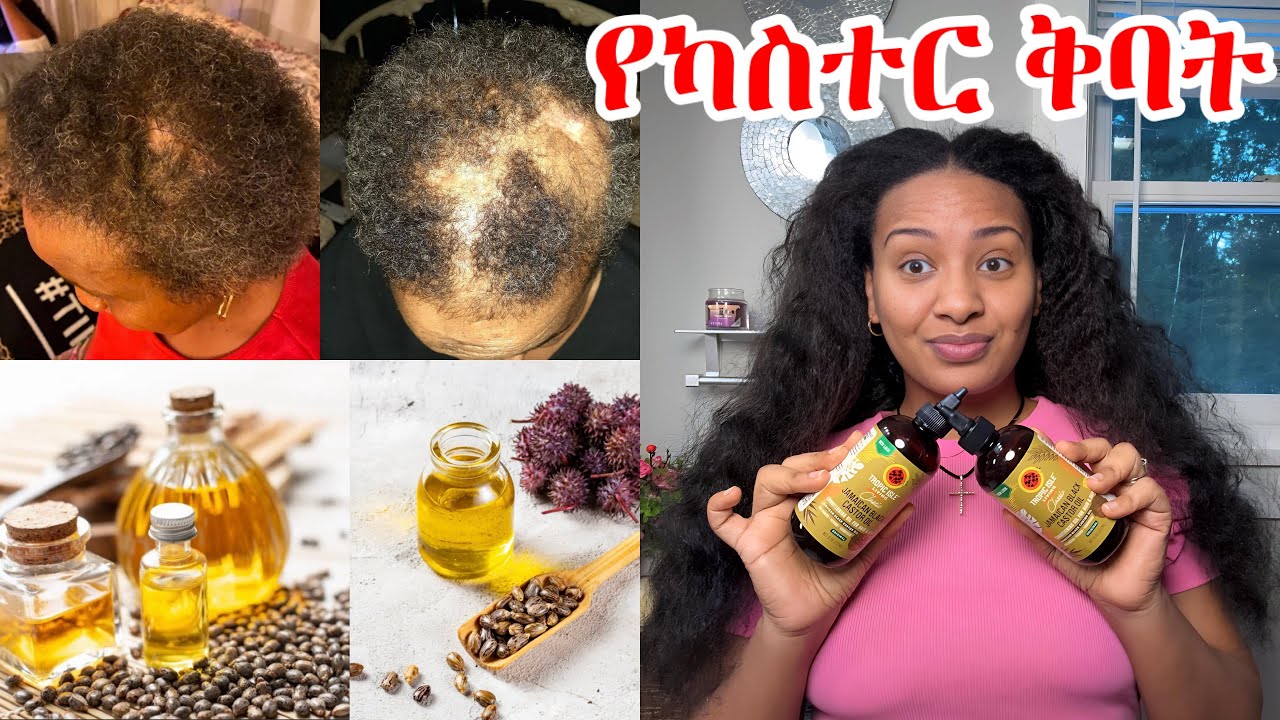 የካስተር ቅባት ፈጣን የፀጉር እድገት ለሚነቀል ትክክለኛ አጠቃቀም ሌላም ጥቅሞቹ // 𝐂𝐚𝐬𝐭𝐨𝐫 𝐨𝐢𝐥 𝐛𝐞𝐧𝐞𝐟𝐢𝐭𝐬 𝐟𝐨𝐫 𝐟𝐚𝐬𝐭 𝐡𝐚𝐢𝐫 𝐠𝐫𝐨𝐰𝐭𝐡 