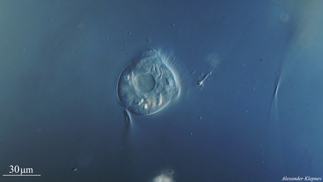 Vorticella under microscope