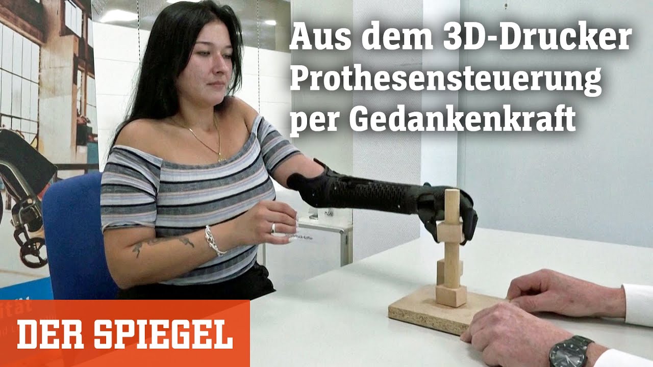 Aus dem 3D-Drucker: Prothesensteuerung per Gedankenkraft | DER SPIEGEL