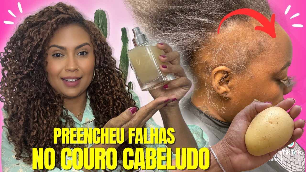 O CABELO CRESCE LOUCAMENTE E NÃO CAI! APENAS 1 BATATA O REMÉDIO MAIS FORTE