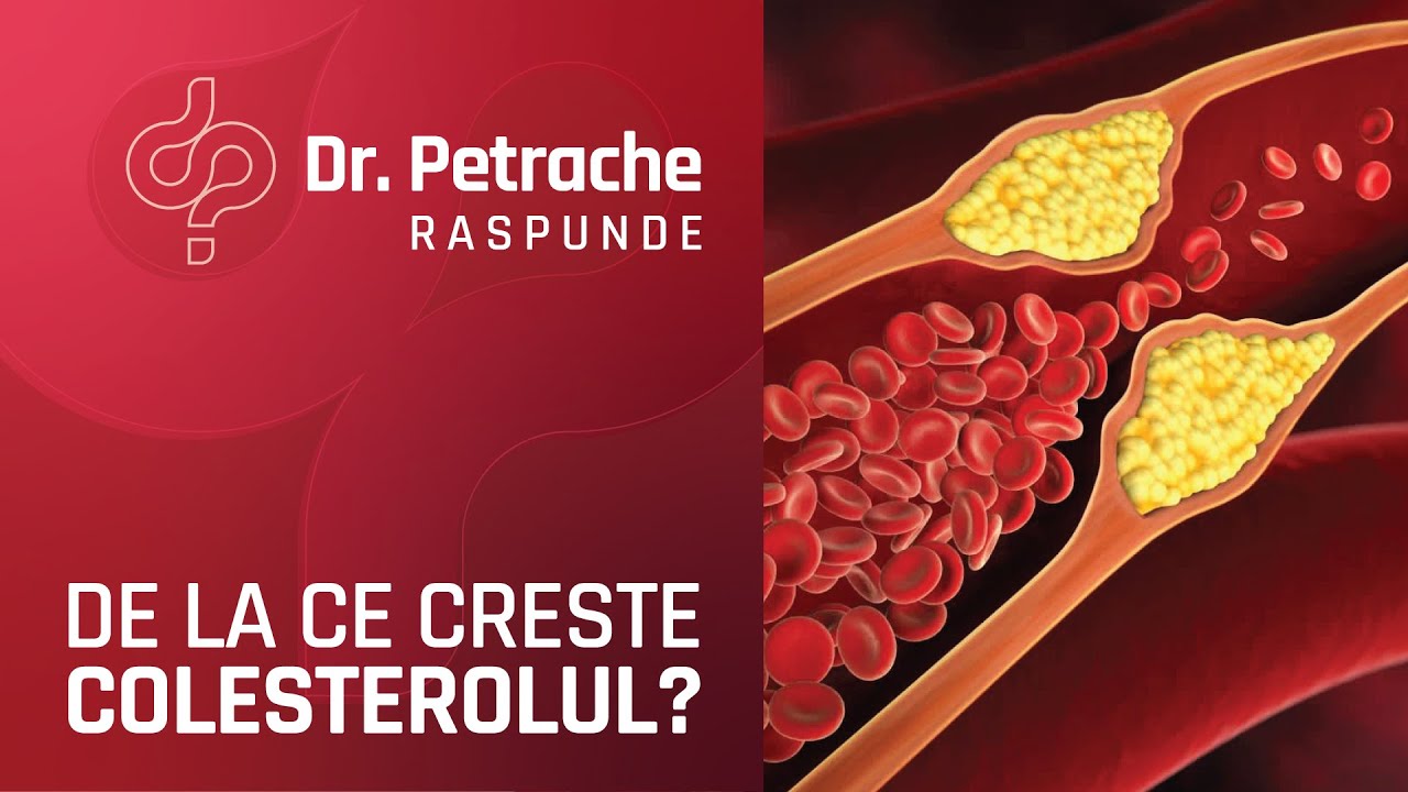 DE LA CE CRESTE COLESTEROLUL?