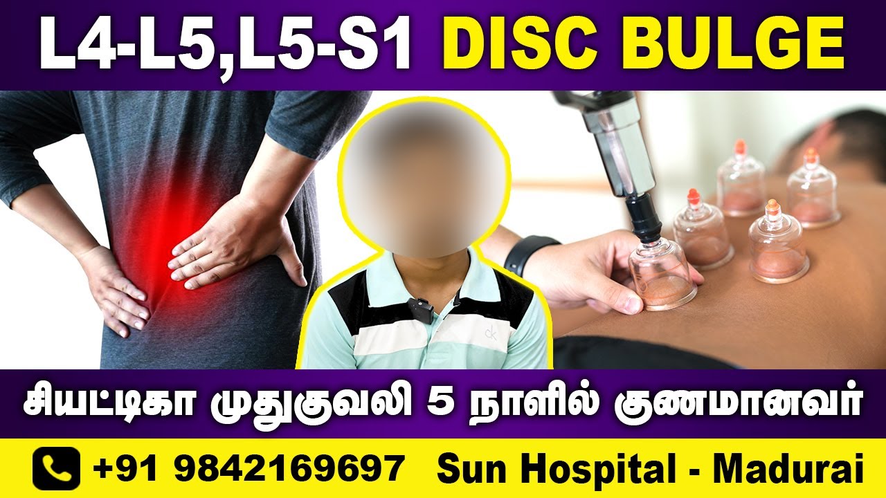 L4-L5-S1 How to Relieve Sciatica Pain (No Surgery )| Stretches & Exercises |Sun Hospital Madurai