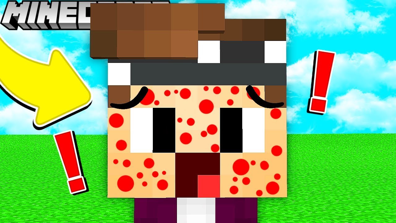 ICH HABE WINDPOCKEN IN MINECRAFT!