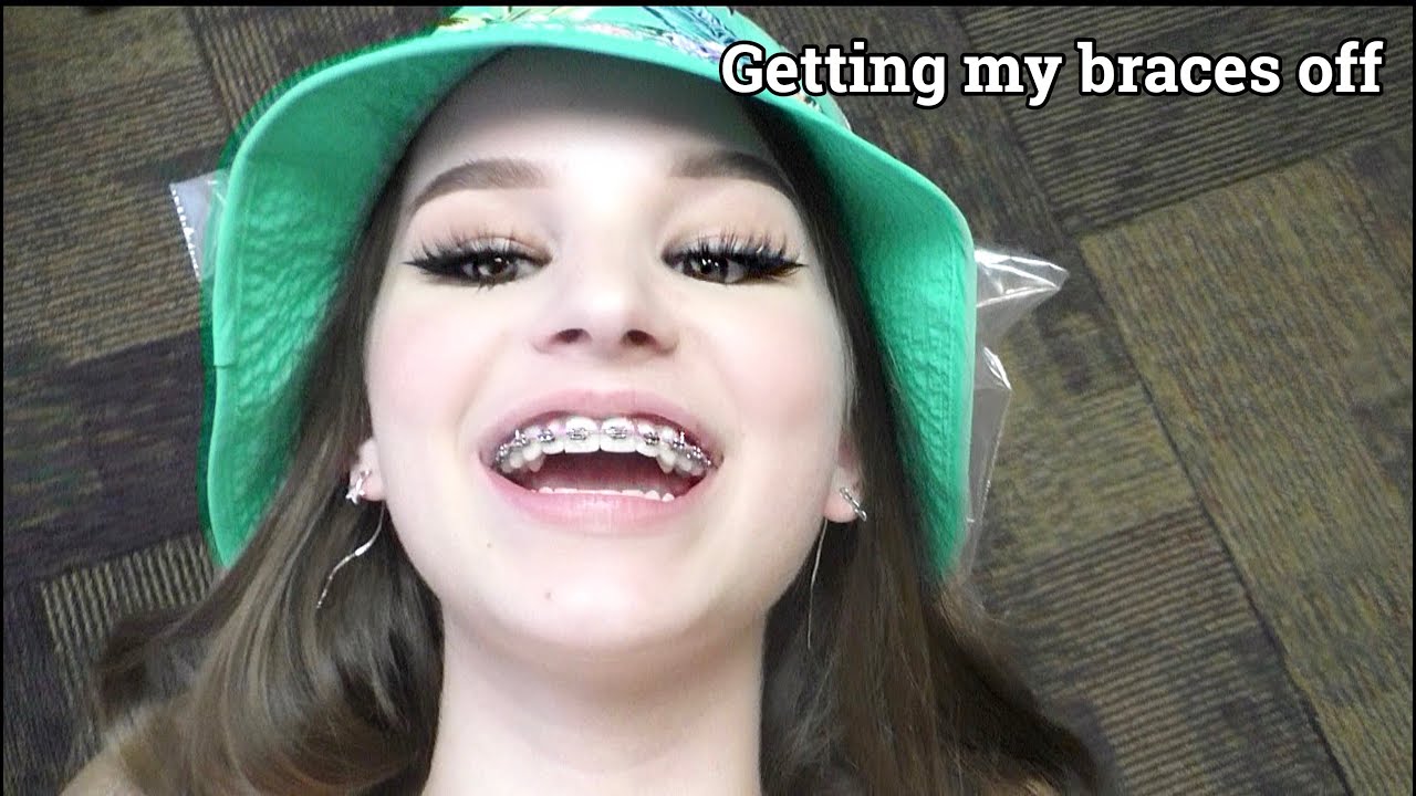 finally getting my braces off