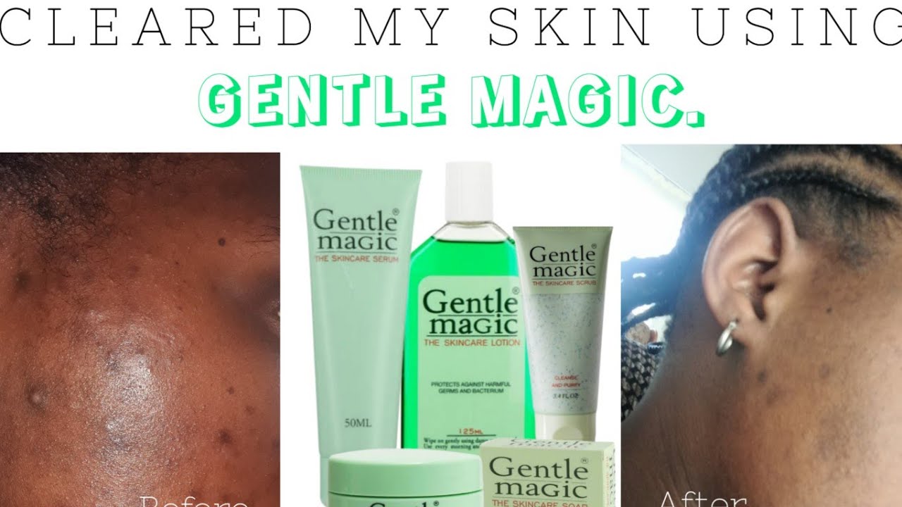 HOW I CLEARED MY SKIN USING GENTLE MAGIC PRODUCTS 💚. | SOUTH AFRICAN YouTuber 🇿🇦