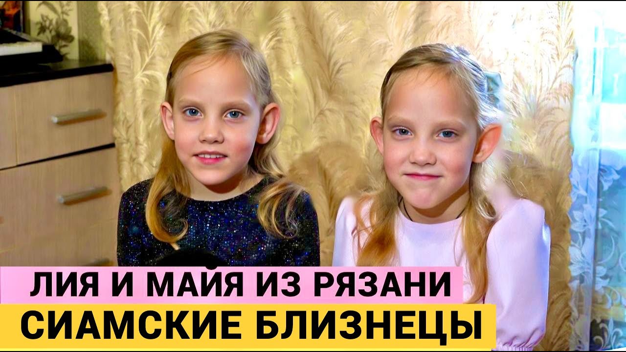 ОНИ ЖЕ СРОСЛИСЬ, А НЕ ОБНИМАЮТСЯ! - ахнула доктор на УЗИ. Сиамским близнецам идет 9 год.