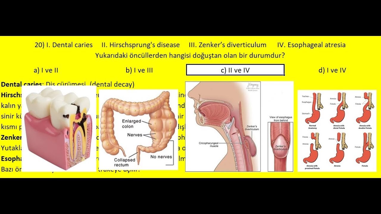Raif Mert ESEN SİNDİRİM SİSTEMİ TIBBİ TERMİNOLOJİ Ders Alıştırmaları