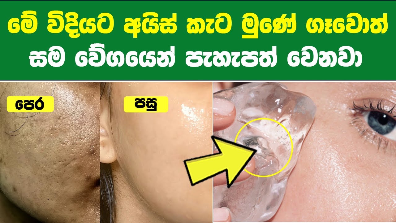 මේ විදියට අයිස් කැට මුණේ ගෑවොත් සම වේගයෙන් පැහැපත් වෙනවා | Ice Cubes Beauty Benefits