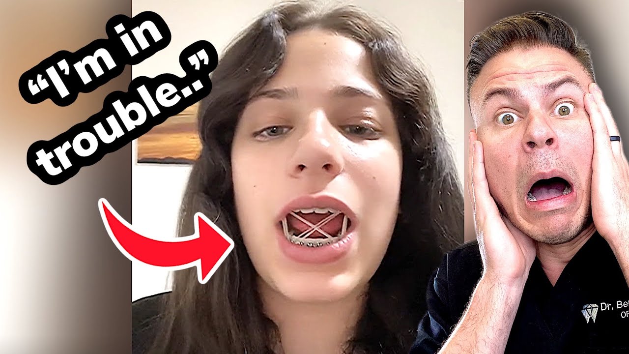 NEVER Make This Braces RubberBands Mistake!