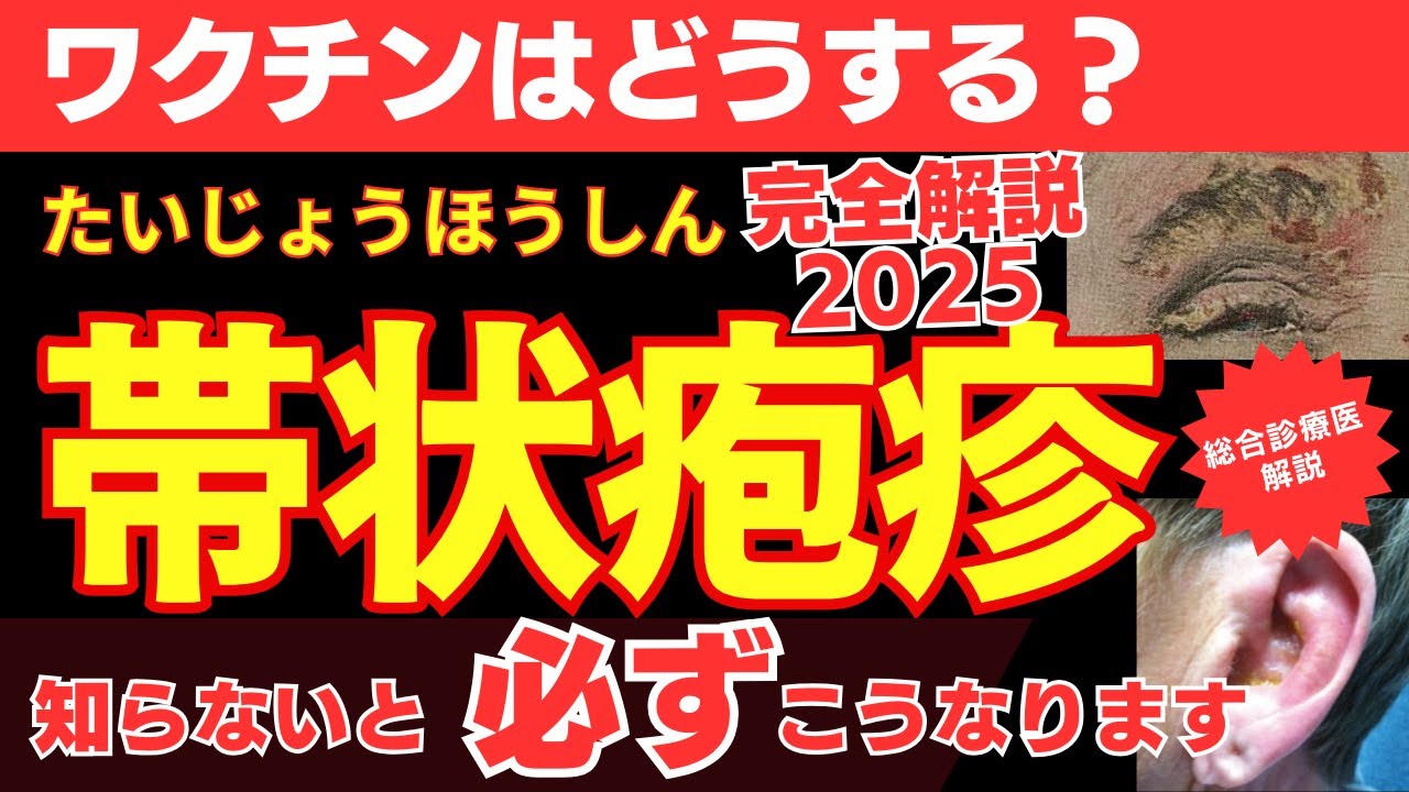 【ワクチンどうする？】知らないと後悔する『帯状疱疹』の危険サイン【総合診療医が予防/ワクチン/後遺症/治療/初期症状を徹底解説2025】