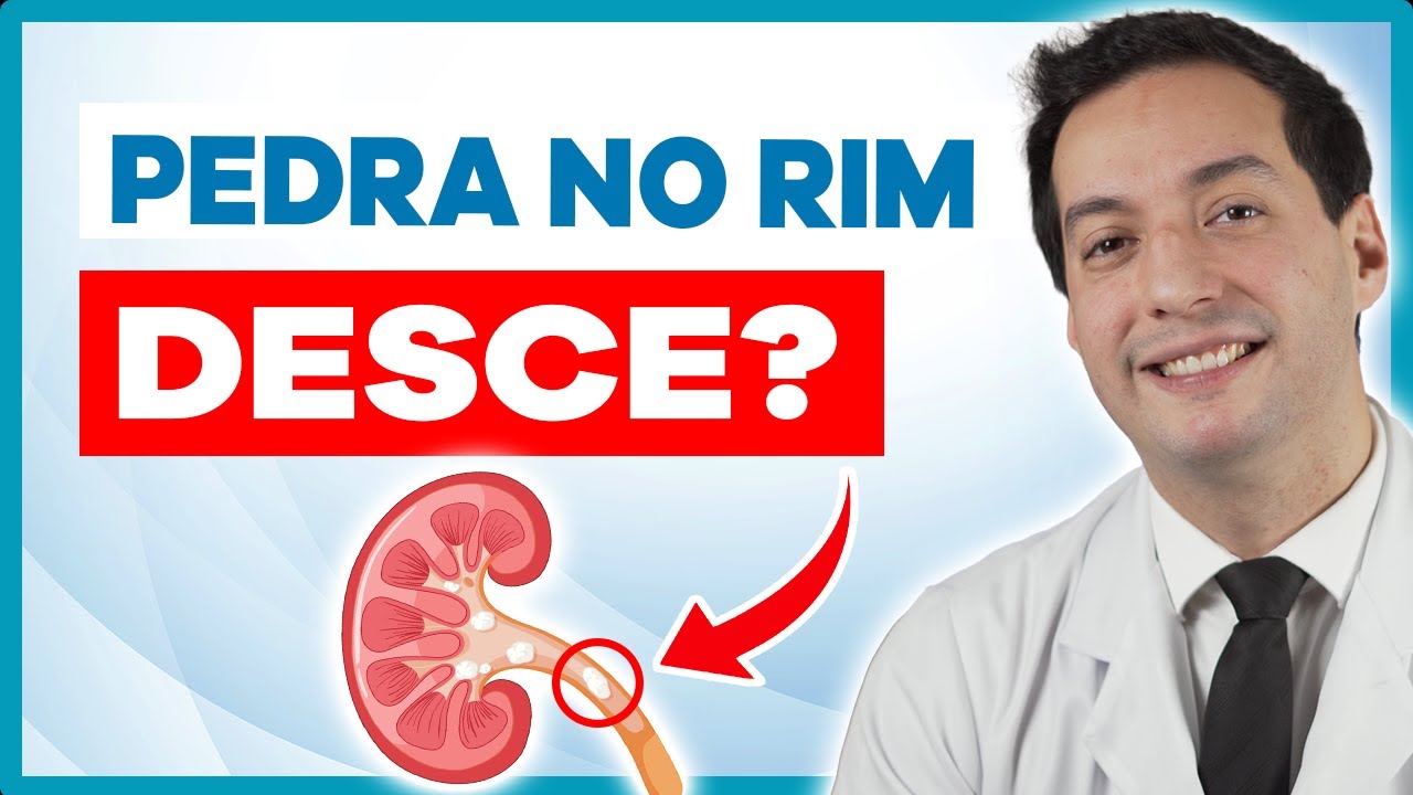 QUANDO A PEDRA NO RIM DESCE PARA A BEXIGA? DR EDUARDO COSTA - UROLOGISTA