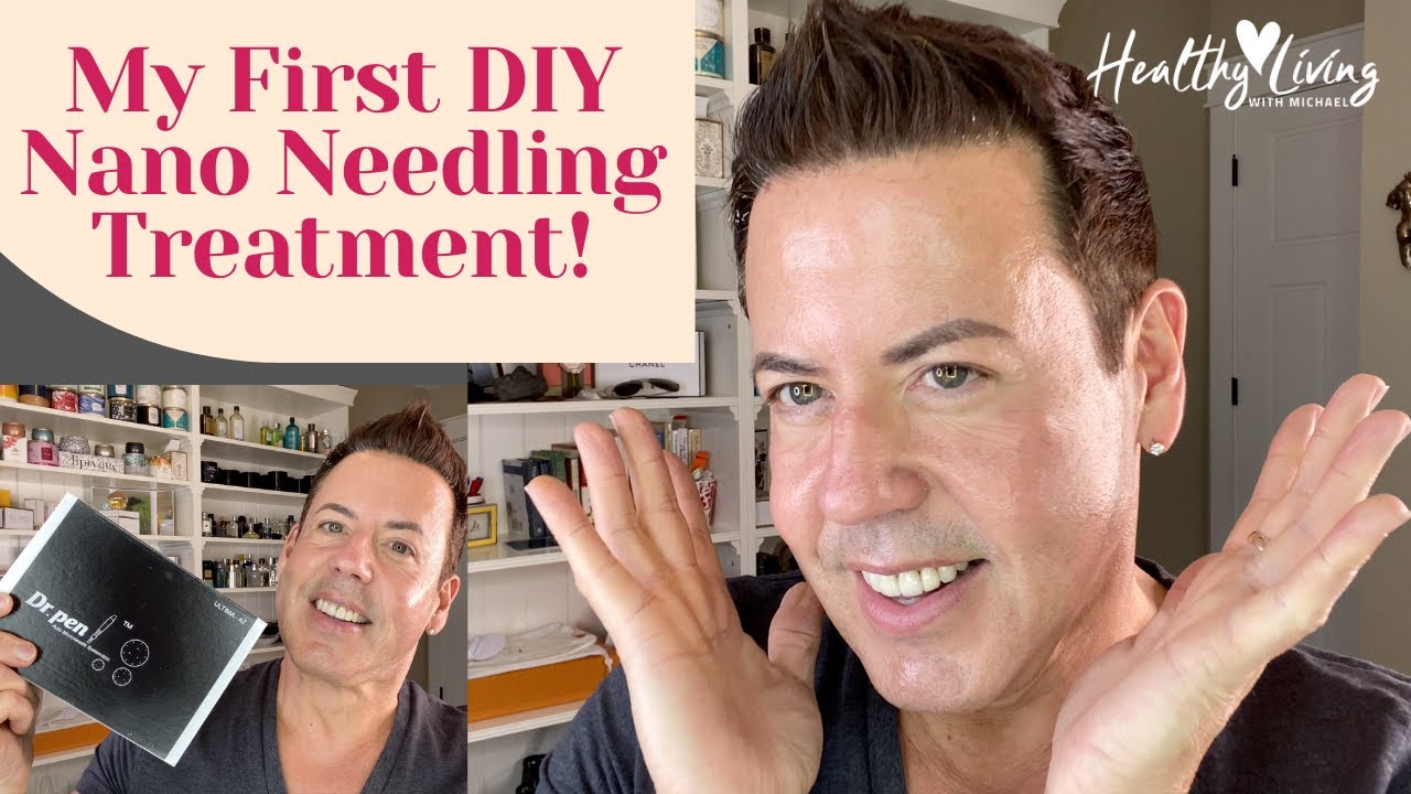 MY FIRST DIY NANO NEEDLING TREATMENT!