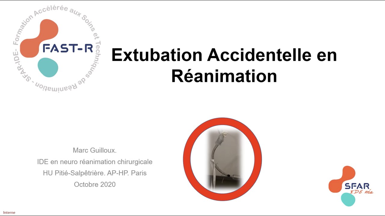 Extubation accidentelle en réanimation