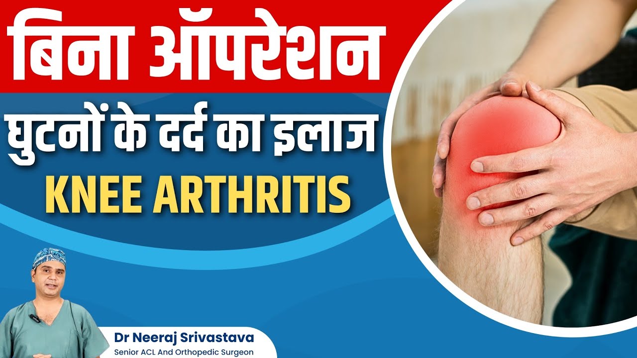 घुटनों का दर्द? Knee Pain Treatment Without Surgery | घरेलू उपाय और एक्सरसाइज - Dr Neeraj Srivastava