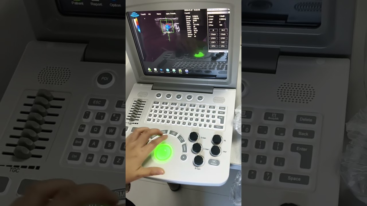 How to operate the portable ultrasound WED-160