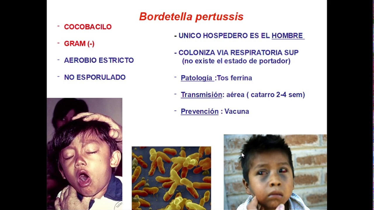 Seminario Injuria 11(A) BG- Fastidiosos