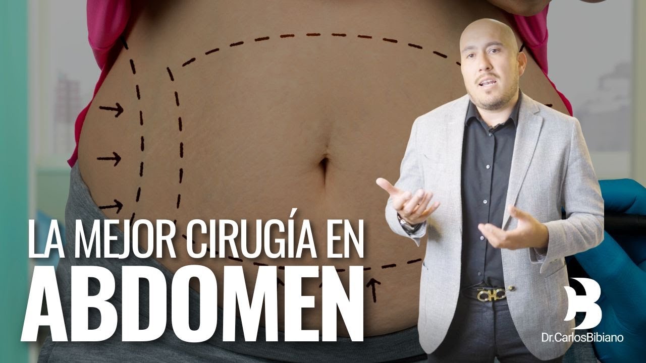 Elimina la barriga con la mejor cirug&iacute;a de abdomen