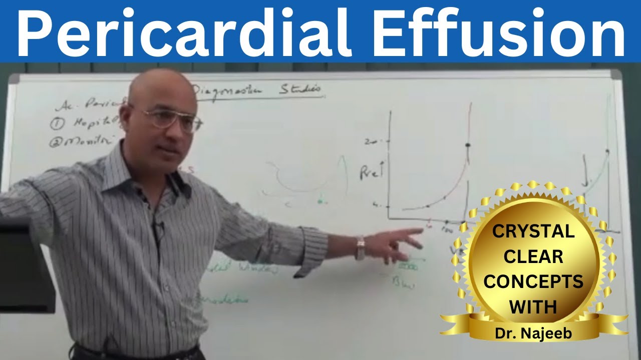 Pericardial Effusion | Pericardium | Cardiology🫀