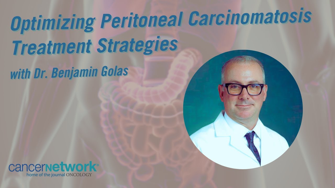 Optimizing Peritoneal Carcinomatosis Treatment Strategies