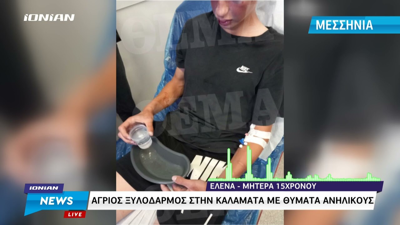 Καλαμάτα | Άγριος ξυλοδαρμός με θύματα ανήλικους - Η μητέρα του 15χρονου μιλά στο ΙΟΝΙΑΝ