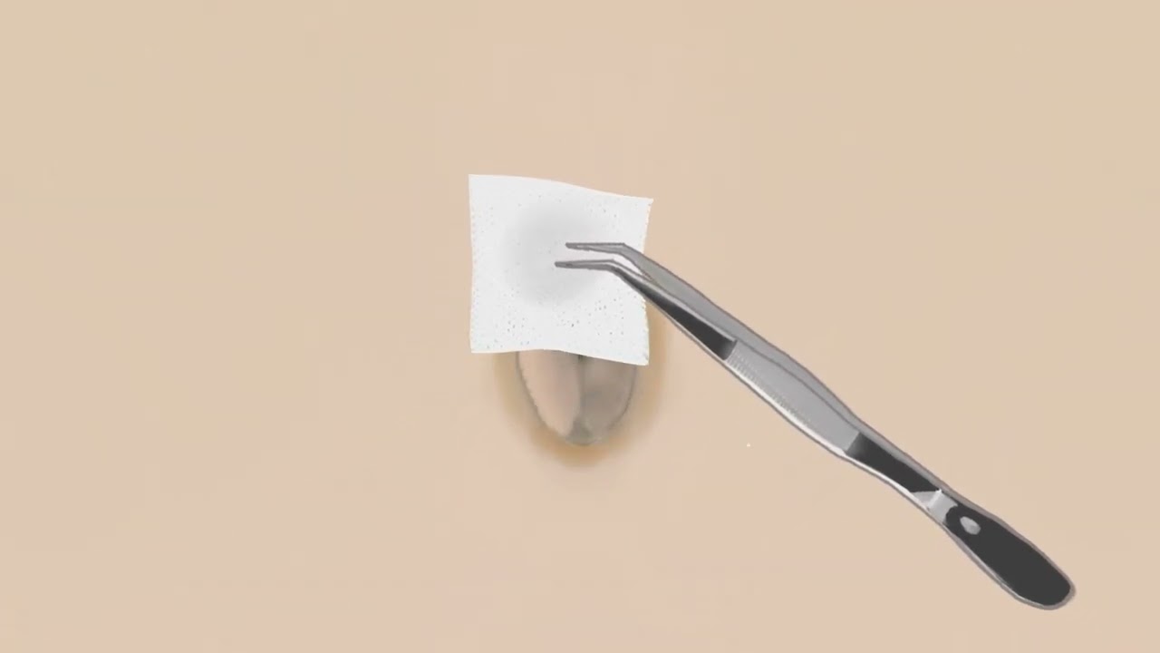 먼지 끼면 아파오는 배꼽때 제거 / Removing navel stone and dirt