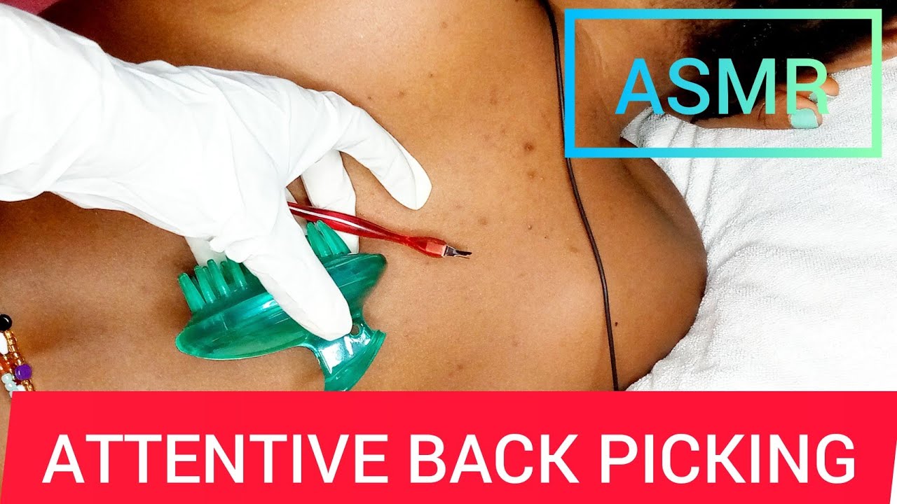 ASMR | BACK PERSONAL ATTENTION | NITPICKING