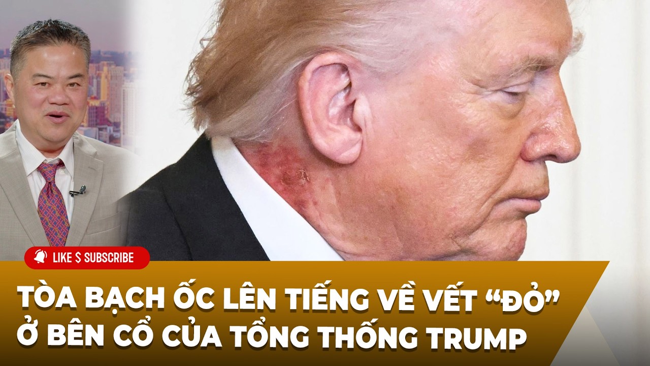 C&agrave; Ph&ecirc; S&aacute;ng P5 (03-03-2026) T&ograve;a Bạch Ốc l&ecirc;n tiếng về vết &ldquo;đỏ&rdquo; ở b&ecirc;n cổ của Tổng thống Trump