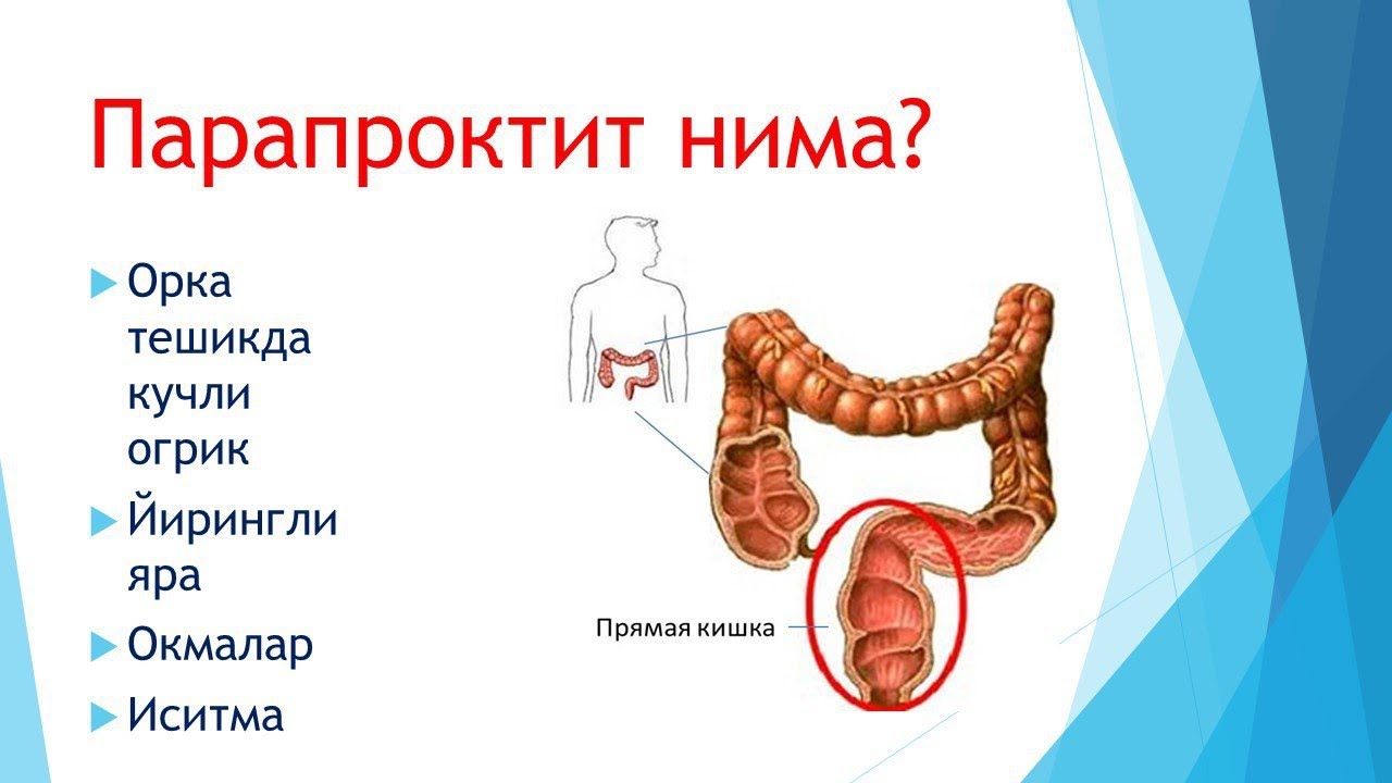 парапроктит қанақа касаллик