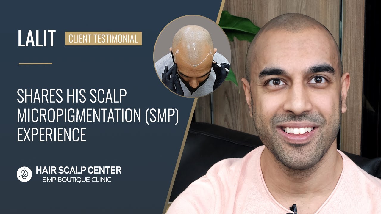 Lalit shares his Scalp Micropigmentation (SMP) experience at Hair Scalp Center in Bangkok, Thailand