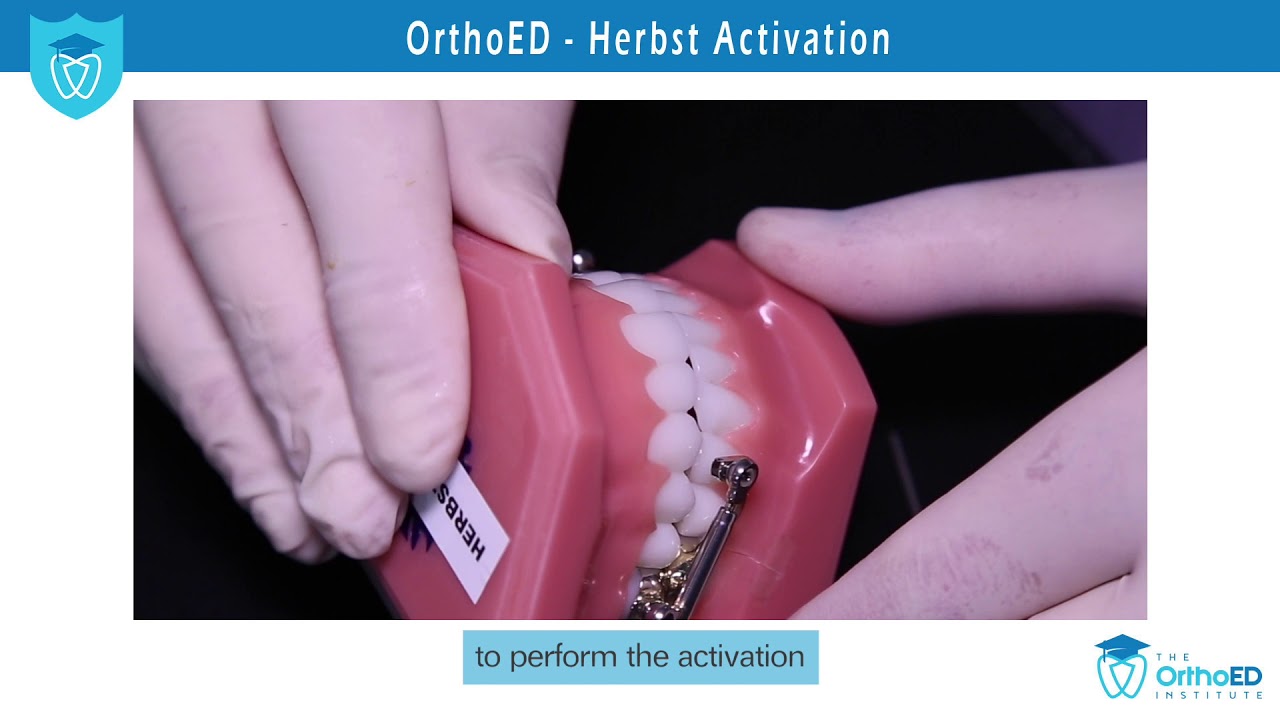 OrthoED   Herbst Activation subs