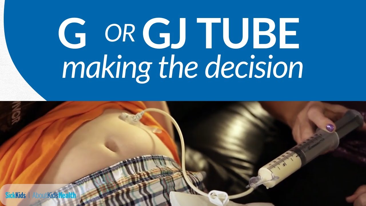 The G/GJ Tube Decision | AboutKidsHealth at The Hospital for Sick Children