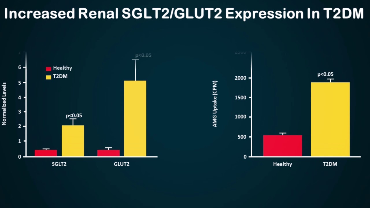 SGLT2 Inhibitors In T2DM