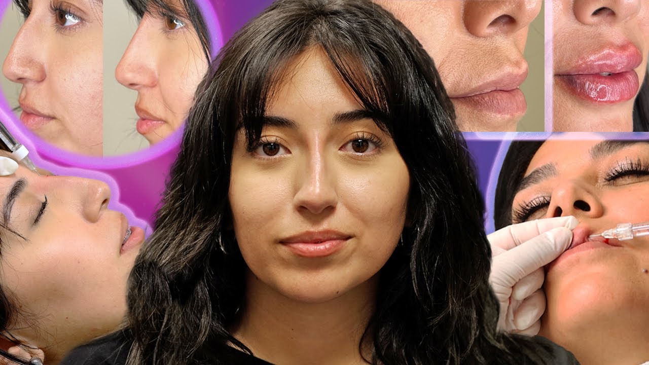 Mother Daughter Fillers (lip and nose) | Life of Eileen Ep 2
