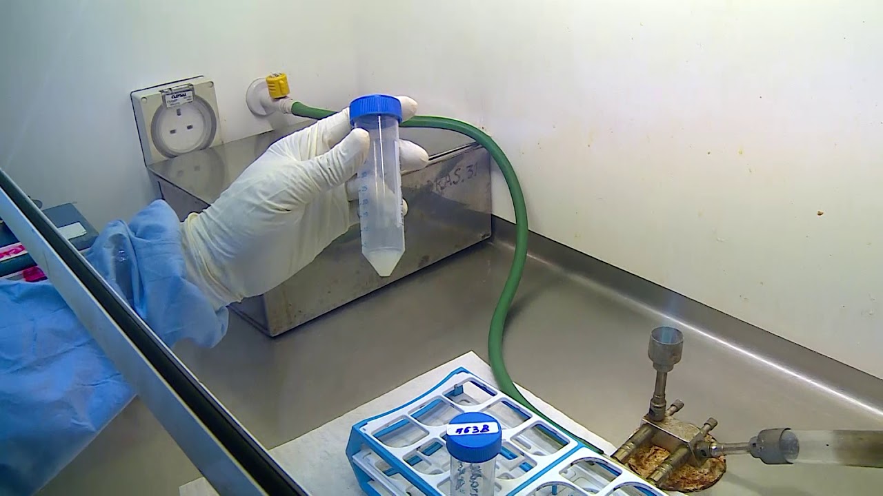10 Demonstration of processing of sputum specimen for culture for diagnosis of tuberculosis