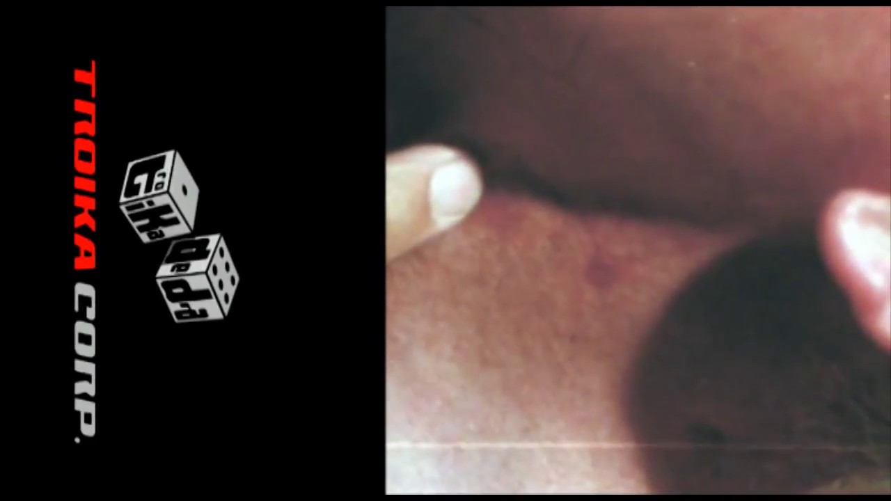 Fecal Verdor - Dj Pata & Mr Pig - Tröikadedra