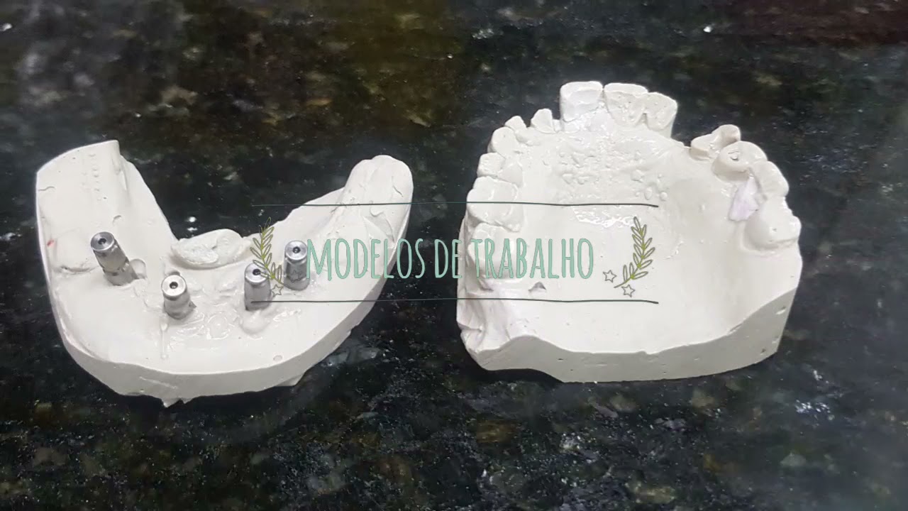 Protocolo Inferior sistema carga imediata,finalizado em 8horas