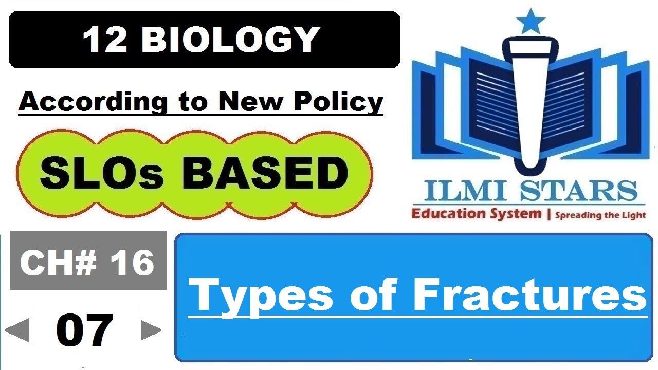 Types of Fractures Class 12 Biology Chapter 16 Federal Board and KPK Board
