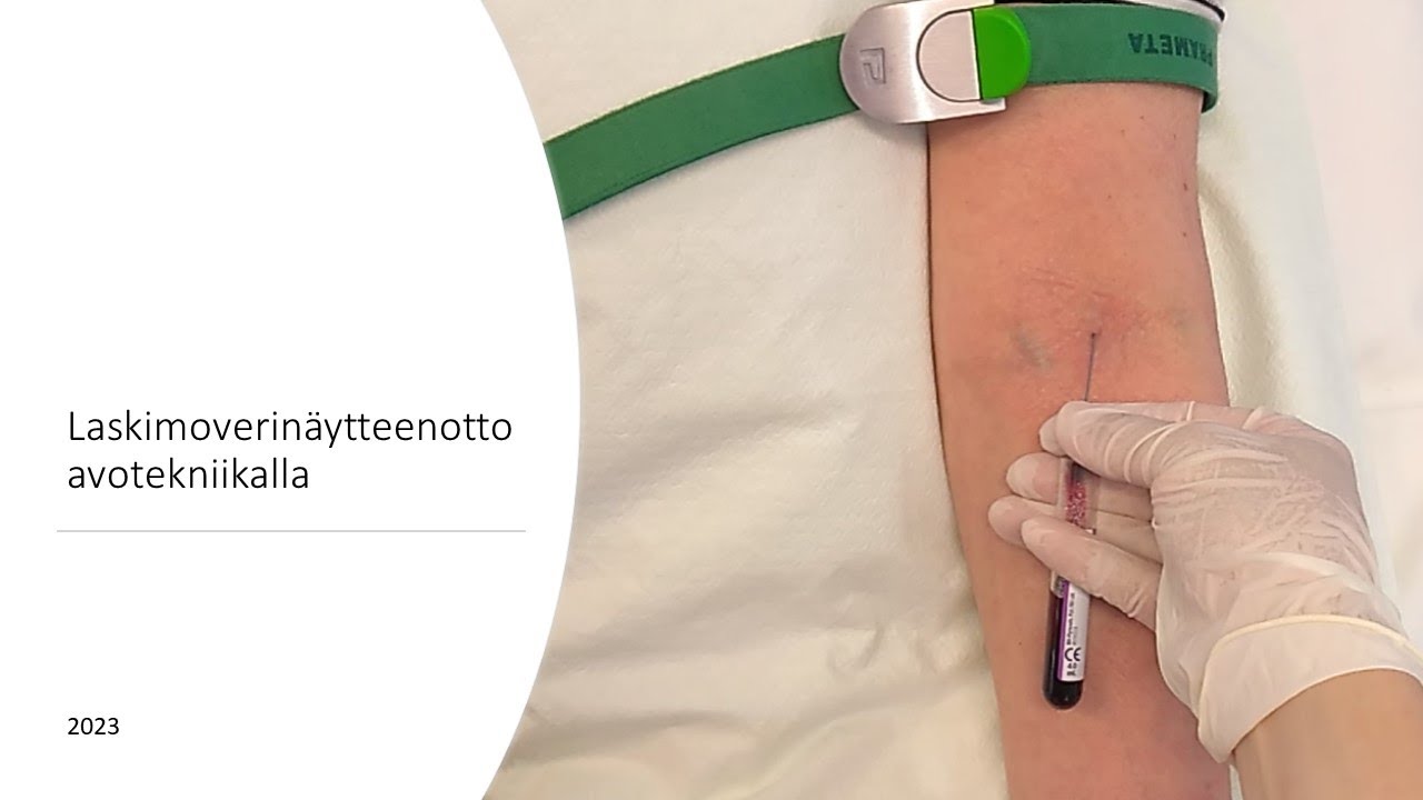 Laskimoverinäytteenotto avotekniikalla