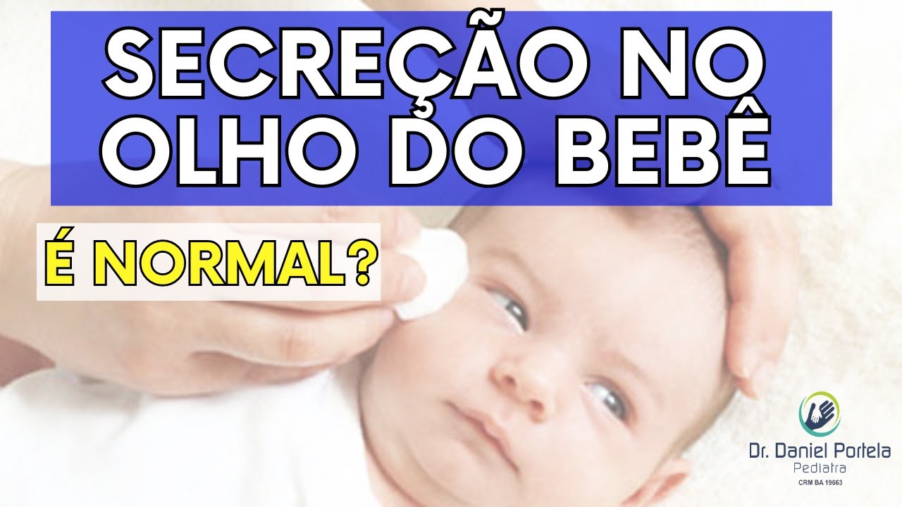 Bebê lacrimejando com remela nos olhos desde que nasceu